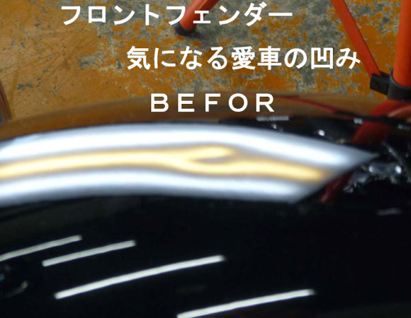 デントリペア1
