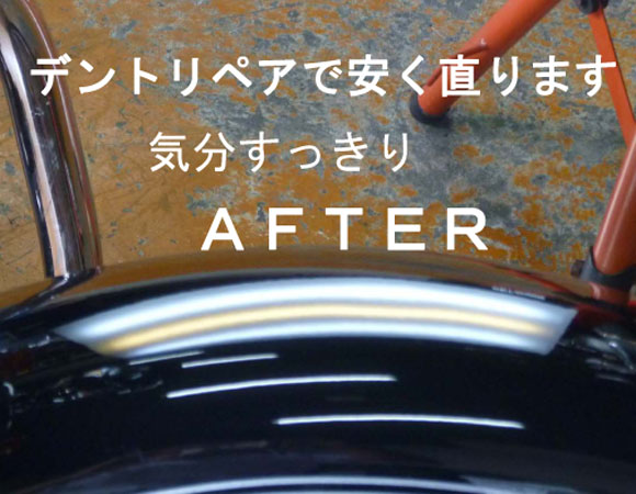 デントリペア2